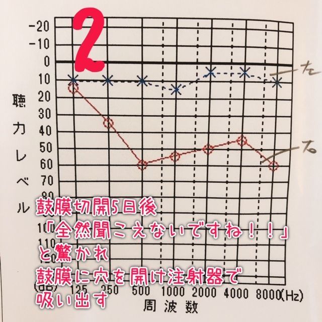 f:id:misumisu0722:20190112114201j:plain